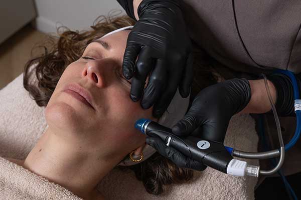 hydrafacial