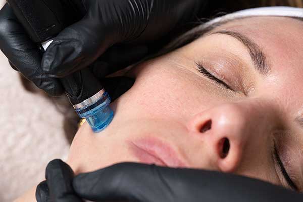 hydrafacial